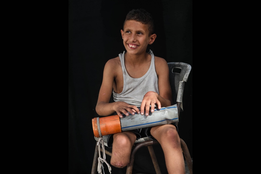 Rateb… A Child Reinventing His Leg